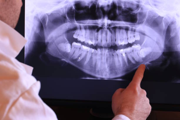 Best Emergency Treatment for Oral Infections in Harlem, GA